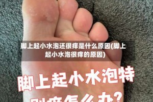 脚上起小水泡还很痒是什么原因(脚上起小水泡很痒的原因)