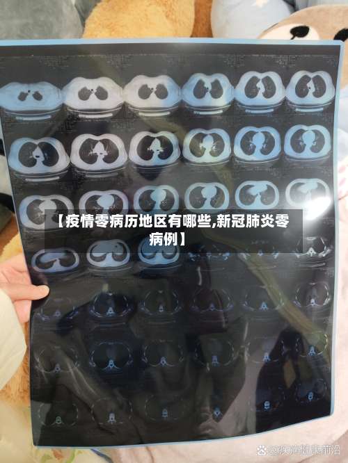 【疫情零病历地区有哪些,新冠肺炎零病例】-第2张图片